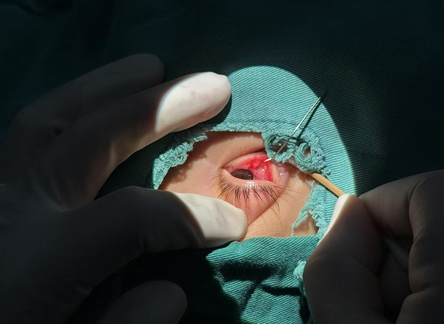 电动玩具车铁丝突扎男童右眼，家长需警惕玩具隐患