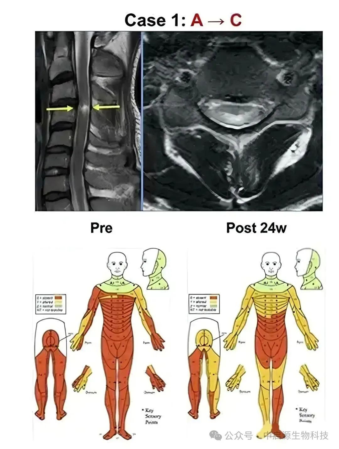行业现状|人民日报点赞细胞疗法：开启疑难重症治疗新纪元