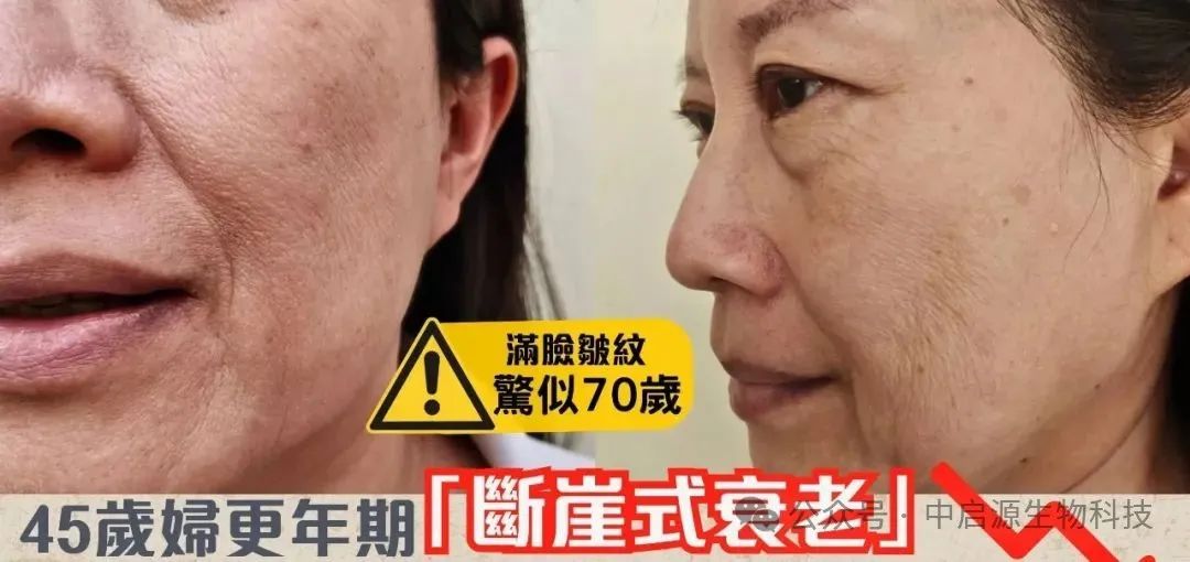 细胞科普丨雌激素↑45%、炎症↓50%、睡眠好30%！干细胞疗法逆转更年期女性断崖式衰老！