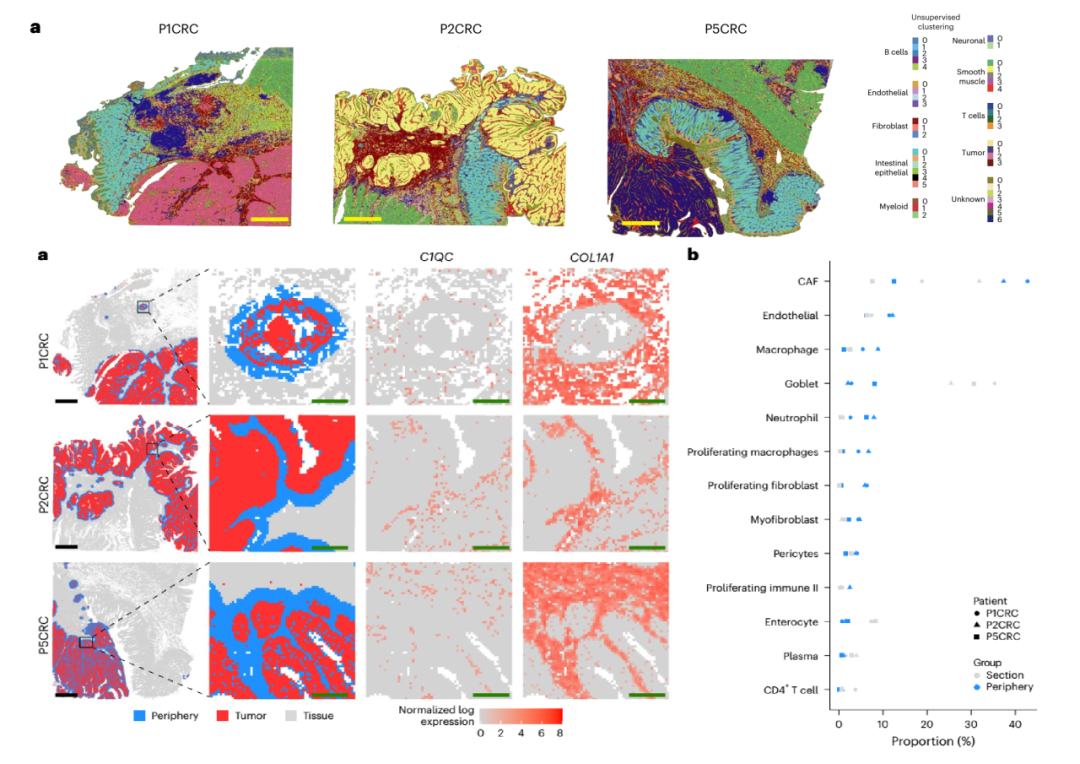 芯空一号快讯 |《Nature Genetics》正式收录！ Visium HD揭示结直肠癌TME免疫亚群全景