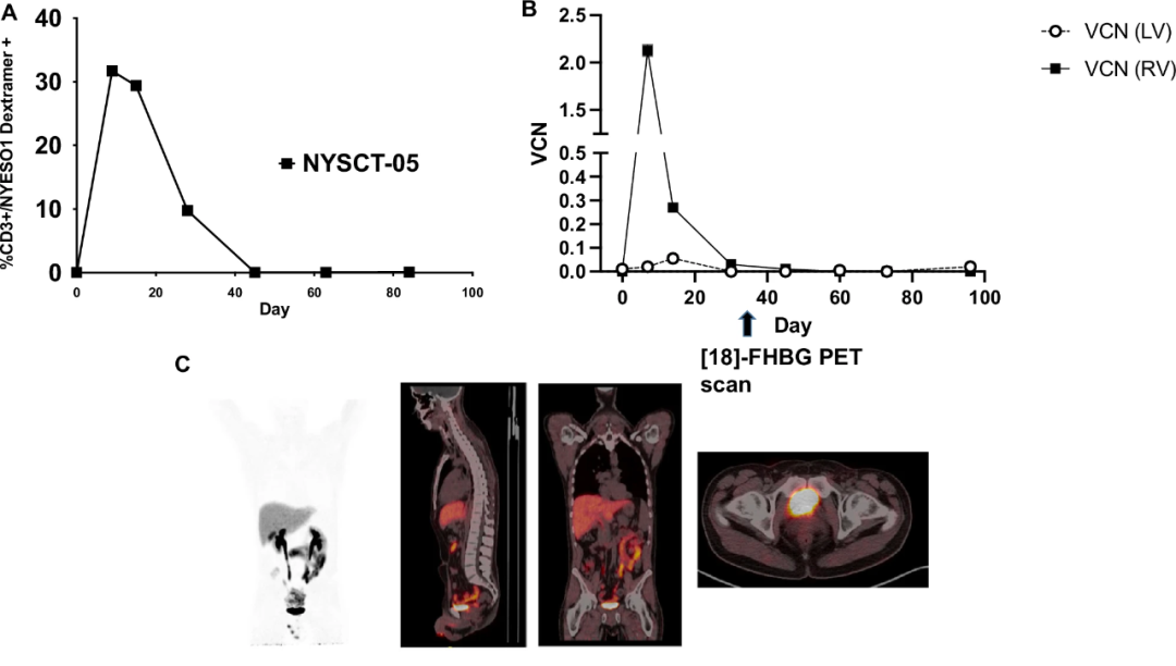 行业动态|41.7%的癌症死亡可预防！全球癌症负担迫近拐点：2023年1040万人死于癌症，2050年或达1860万